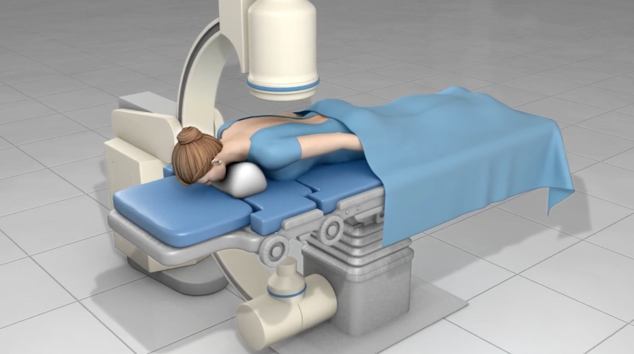 Discography Des Moines, Iowa Discogram Procedure for Back Pain