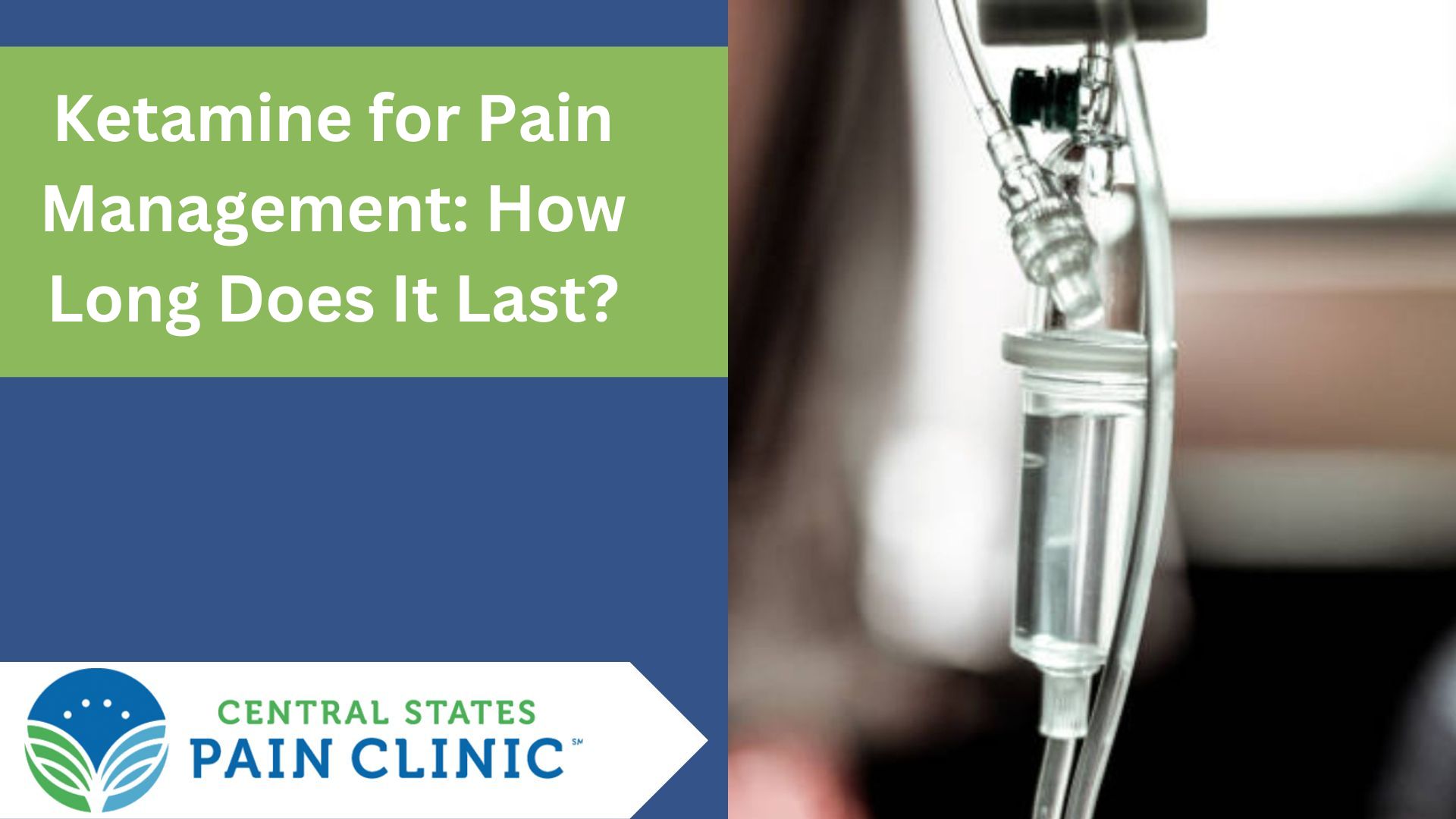 Ketamine for Pain Management: How Long Does It Last?